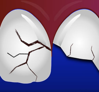 Traumatismos Dentários